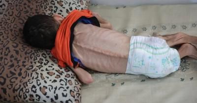 أخبار اليمن : 124 شهيداً جراء التجويع في غزة