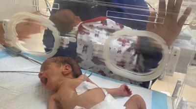 أخبار اليمن : "مقتلة جماعية" وشيكة بحق 100 ألف طفل في غزة