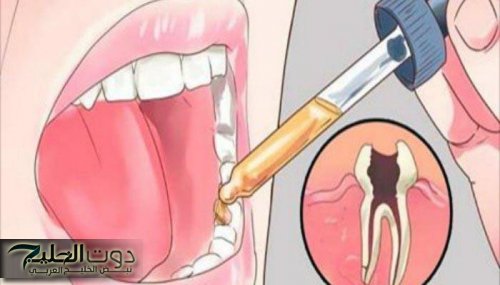 وصفة سحرية للتخلص من آلام الأسنان في دقيقتين