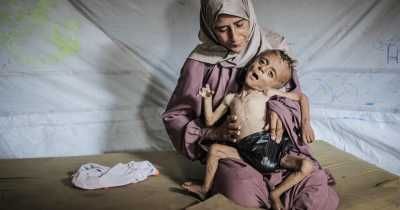 أخبار اليمن : المجاعة في غزة: 162 شهيداً بينهم 92 طفلاً