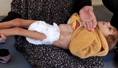 أخبار اليمن : ارتفاع شهداء التجويع في غزة إلى 197