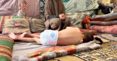 أخبار اليمن : ارتفاع شهداء التجويع بغزة إلى 222