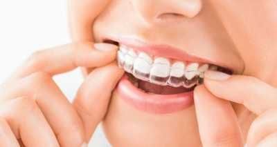 5 نصائح لصحة الأسنان واللثة