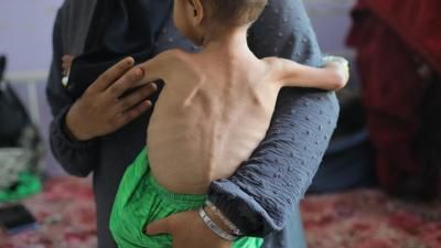 أخبار اليمن : ارتفاع عدد شهداء التجويع بغزة إلى 235