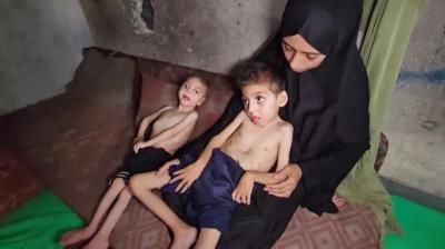 أخبار اليمن : 239 شهيداً جراء التجويع في غزة