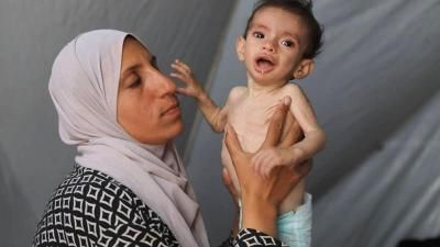 أخبار اليمن : كارثة إنسانية غير مسبوقة في غزة