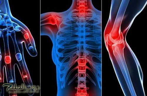 وداعاً لآلام المفاصل.. الوصفة السحرية للتخلص من ألام المفاصل في أسبوع