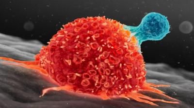 فيروسات يمكن أن تسبب سرطان الكبد