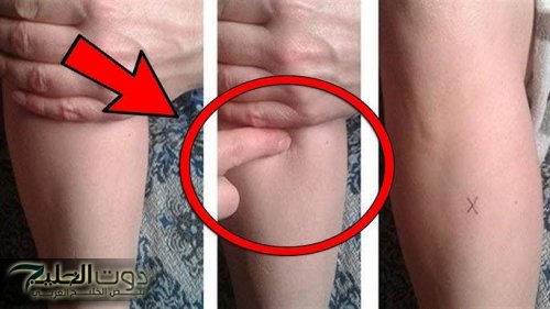 اكتشاف مذهل.. نقطة في جسمك تشفي الأمراض وتفقدك نصف كيلو يومياً