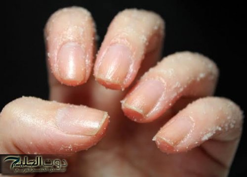 “عارضة أزياء سورية عرفتني الكنز”.. خلطة سرية للتخلص من الجلد الميت حول الأظافر وتبيض اليدين خلال 10 دقائق