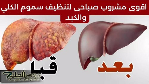 "من غير ادوية ومواد كيماوية!!!...تمتعي بكلى صحيه ونظيفة بخطوات بسيطة وبدون تكاليف...عيشي حياتك بشكل