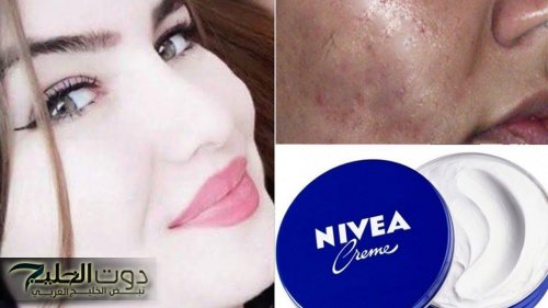 «ممنوع لغير المتزوجين» .. وصفة كريم نيفيا اللي قلبت السوشيال ميديا .. هتحققي بيها المعجزة