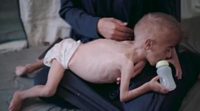 أخبار اليمن : 300 شهيد جراء التجويع في غزة