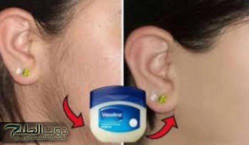 "السر اللي مخبيينه خبراء التجميل".. تخلصي من الشعر الزائد في دقائق بالفازلين وبطريقة آمنة 100%!!