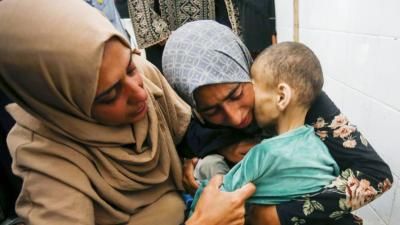 أخبار اليمن : ارتفاع عدد شهداء التجويع بغزة إلى 367