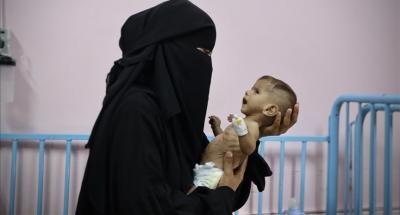 أخبار اليمن : 373 شهيداً جراء التجويع في غزة