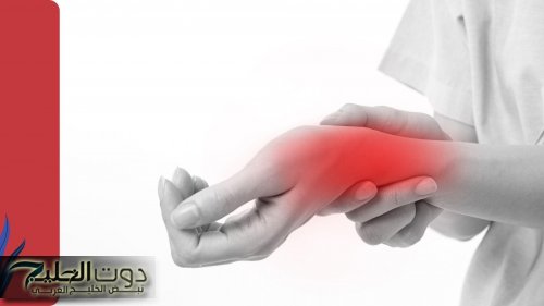 أخيرًا .. "فرحة عارمة" .. نبات سحري يعتبر الحل الأمثل لتقليل التورم والالتهابات وعلاج النقرس