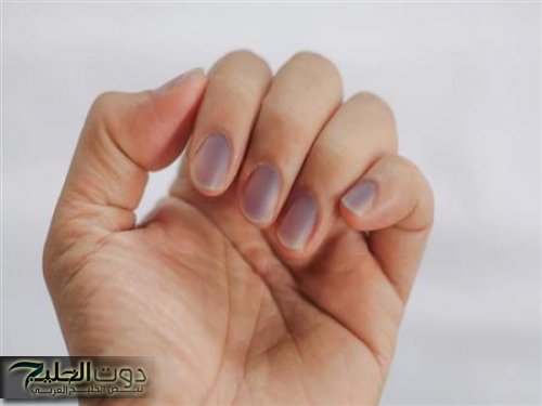 علامات للكبد الدهني تظهر على اليدين.. اعرفها