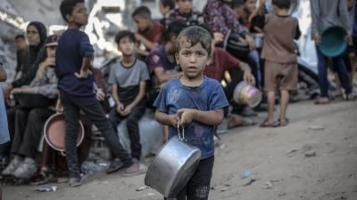 أخبار اليمن : 413 شهيداً جراء التجويع في غزة