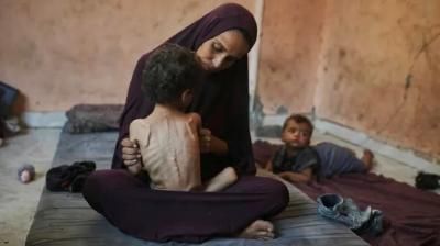 أخبار اليمن : 435 شهيداً جراء التجويع في غزة