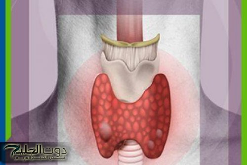 "أخطر من المتوقع".. علامات لا يلاحظها أحد تكشف إصابتك بسرطان الغدة الدرقية مبكرا
