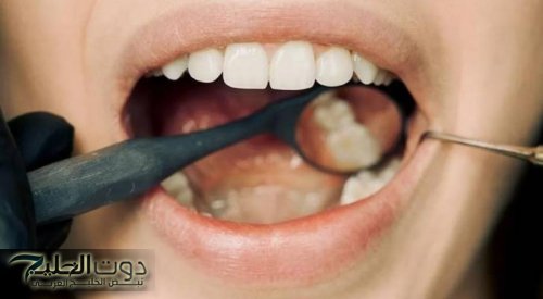 3 أسباب خفية تتجاوز نظافة الأسنان