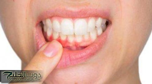 في كل بيت.. تناول 3 أكواب من هذا المشروب يوميًا يحارب الجير ويقوي الأسنان