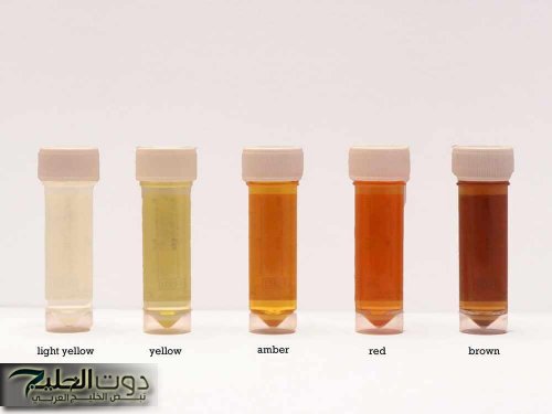 ألوان البول المختلفة ومعانيها الصحية.. تعرف عليها