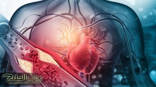 دراسة: 99% من أمراض القلب سببها 4 عوامل فقط