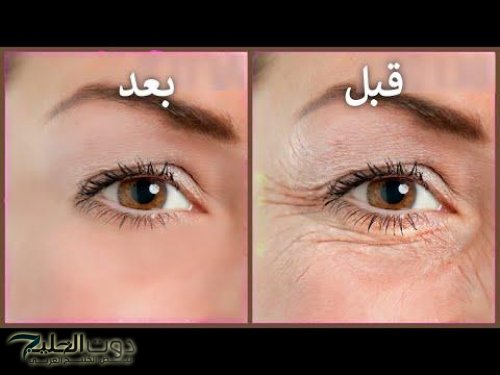 خلي التجاعيد وراك وصفة طبيعية مذهلة لشد البشرة وإعادة الشباب مهما كان عمرك