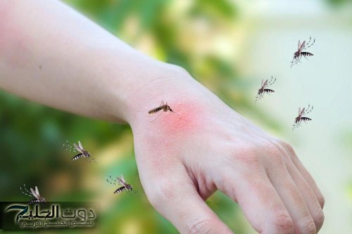 "من الحكة الي مرض!!"... ناموسة واحدة ممكن تدمر صحتك ودكتور شهير يكشف إزاي تحمي نفسك وأولادك