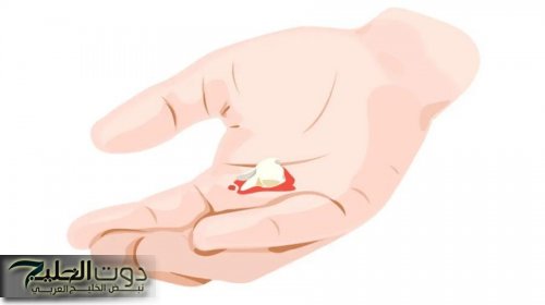 فقدان الأسنان قد يكون نذير شؤم .. ما دلالته