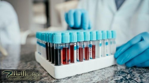لو عمرك 40 سنة.. أربعة فحوصات دم تنقذ حياتك