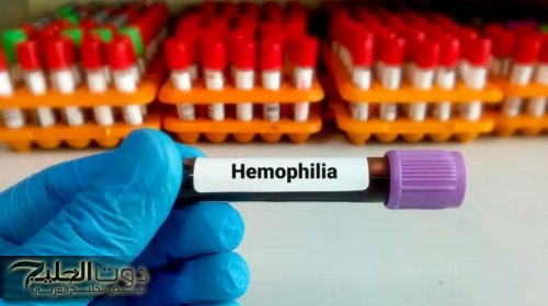 7 فحوصات دم ضرورية بعد سن الأربعين