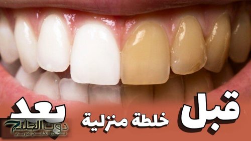 أبرزها «قشر الموز».. 5 طرق طبيعية وآمنة لأسنان بيضاء وأنت في المنزل