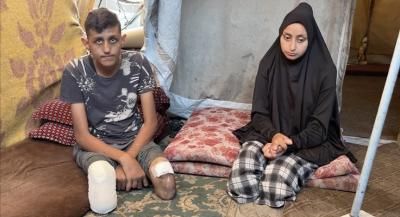 أخبار اليمن : صحة غزة: 6 آلاف حالة بتر بحاجة لتأهيل عاجل