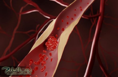 بشرى لمرضى القلب .. دواء جديد يخفض الكوليسترول الضار 60% ويقي من الجلطات