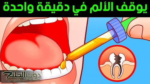 وصفة سحرية للتخلص من آلام الأسنان في دقيقتين
