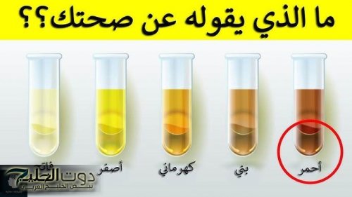 ظهور هذه العلامة على البول دليل على إصابتك بمرض خطير.. أوعى تتجاهلها