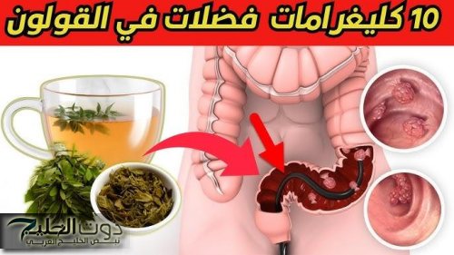 ضاع عمرنا واحنا منعرفش أنها كنز كبير .. العشبة الخارقة لتنظيف القولون وتطهير الأمعاء من البراز المتحجر