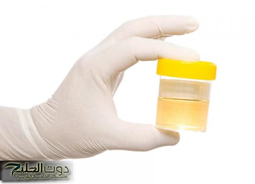 الرغوة في البول جرس إنذار يشير الإصابة بمرض خطير في هذه الحالة