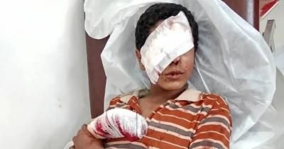 أخبار اليمن : 10689 مدنياً ضحايا المتفجرات في اليمن