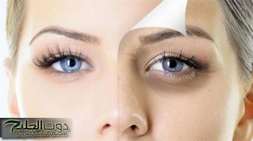 نصائح لهالات تحت العين