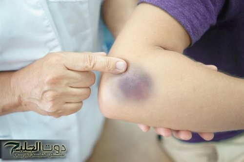 مش زعل بس.. هذه العلامات مؤشر لمرض يسبب الوفاة