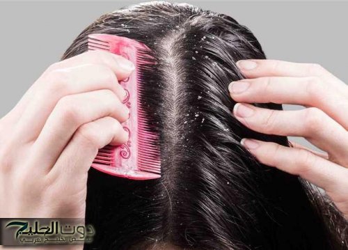 جربيها مرة وهتدعيلي من قلبك!! ..وصفة الأعشاب السحرية لتنعيم الشعر ومنع القشرة في وقت قياسي.. هتشوفي النتيجة