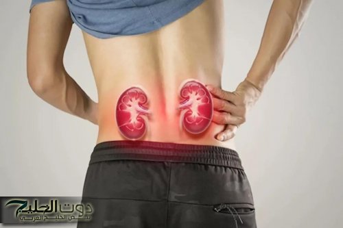 علامات تشير إلى إصابتك بمشكلات فى الكلى