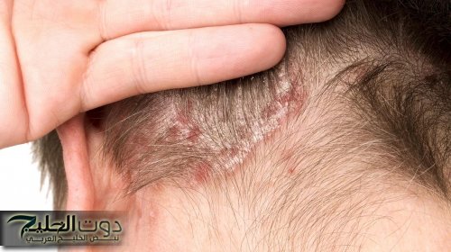 احذري النوم بالشعر المبلل في الشتاء.. مخاطر صحية لا يستهان بها