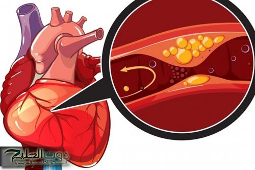حسام موافي يحذر: هذه الأمراض تسبب ضيق الشريان التاجي