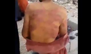 فيديو صادم يهز مواقع التواصل يوثق تعرض شاب يمني للتعذيب الوحشي في سلطنة عمان..اتفرج