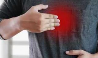حرقة المعدة.. لا تهملها!